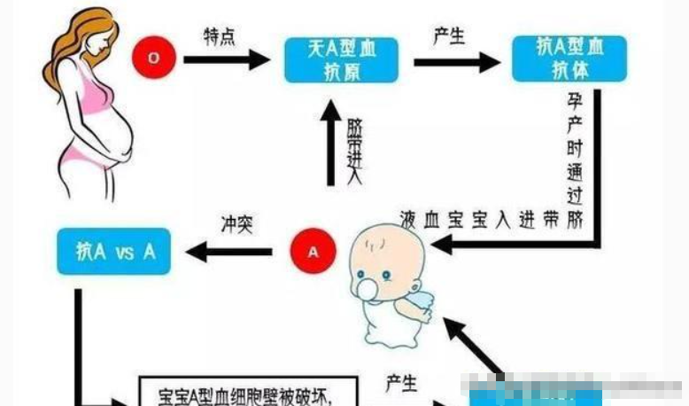 ABO血型不合溶血病的预防与诊断：母婴健康的关键指南