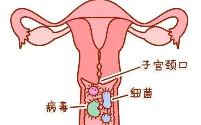 探析轻度宫颈炎的常见病因及预防措施